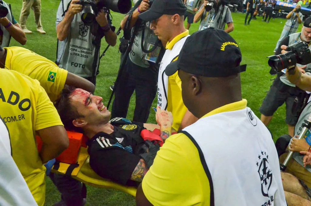 A bloodied fan is taken away on a stretcher Brazil vs Argentina fan violence - Maracana 5 